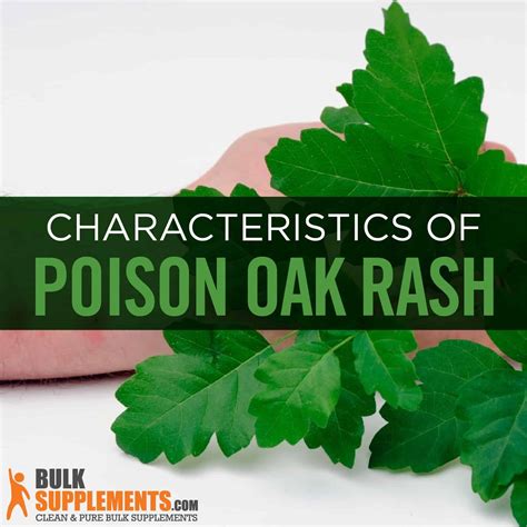 Poison Oak Rash Causes Characteristics And Treatment