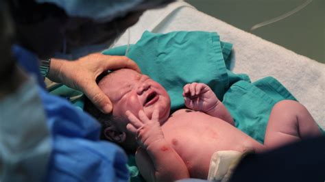 Swabbing Cesarean Born Babies With Vaginal Fluids Potentially Unsafe