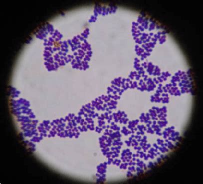 Staphylococcus Aureus Seen Under Microscope After Gram S Staining
