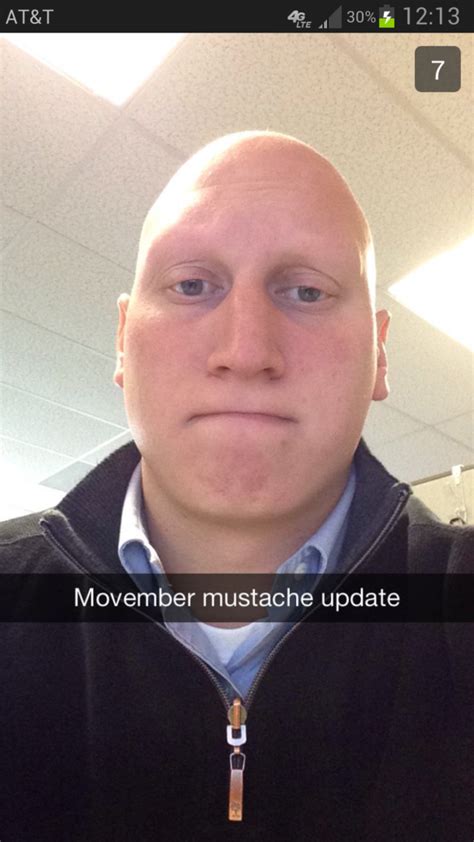 My Friend Has Alopecia This Is His Movember Mustache