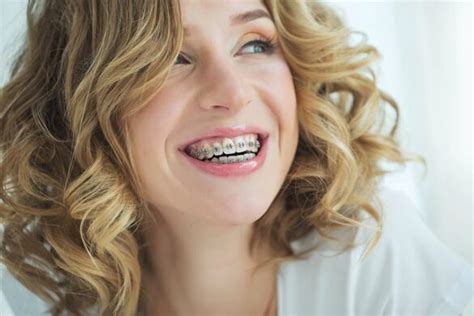 The Emotional Impact Of Having Braces Tips For Coping With Insecurities Ilfc