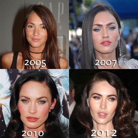 Megan Fox Plastic Surgery Progression