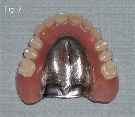 Dentures Procare Dental