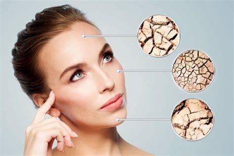 7 Effective Tips To Treat Dehydrated Skin Repair It Hergamut