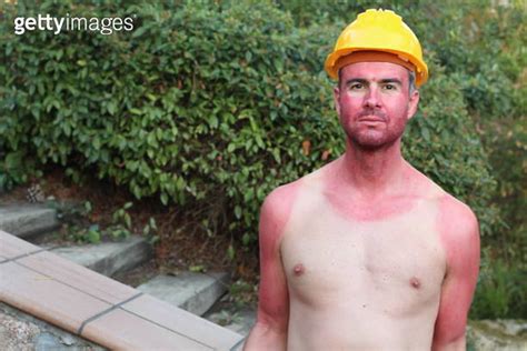 Sunburned Construction Worker With Extreme Tan Lines 이미지 1203803194
