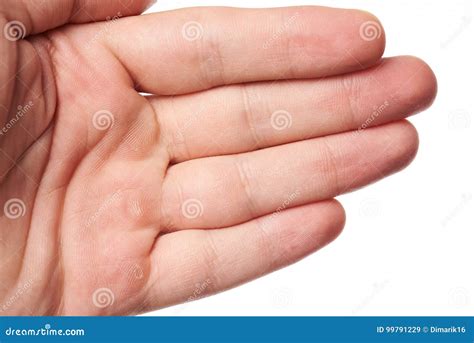 Hand Palm With Blister Stock Image Image Of Male Pattern 99791229