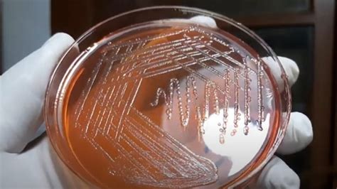 Proteus Vulgaris Introduction Identification Features Keynotes