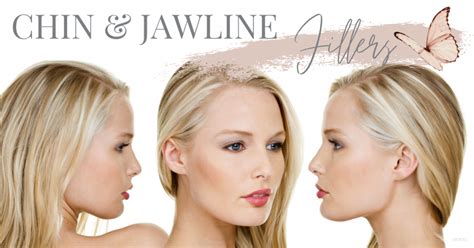 We Answered All Your Questions About Chin And Jawline Fillers JuvÉderm
