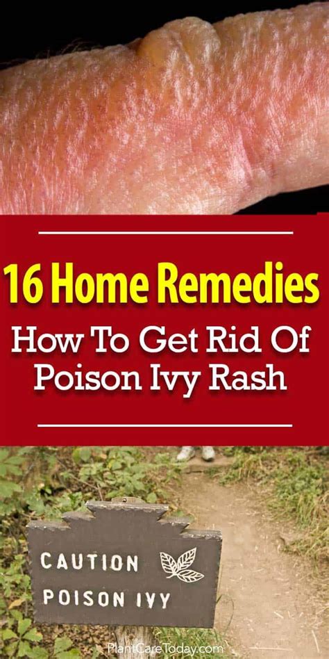 How To Get Rid Of Poison Ivy Skin