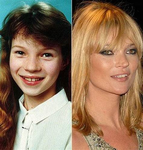 Celebs Then And Now Part 3 Celebrities