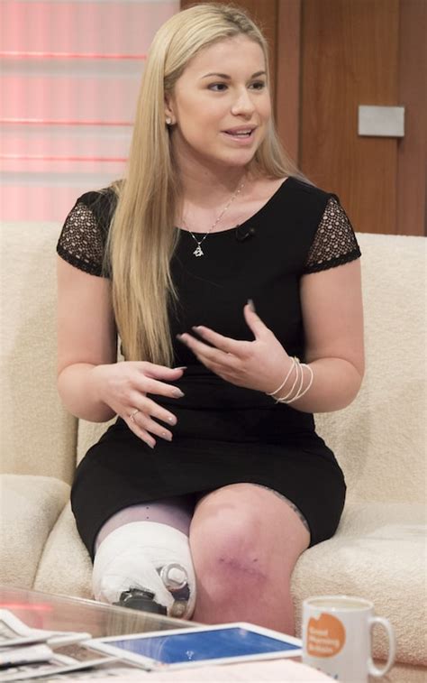 Former Dancer Who Lost Leg In Crash On The Smiler At Alton Towers Gets