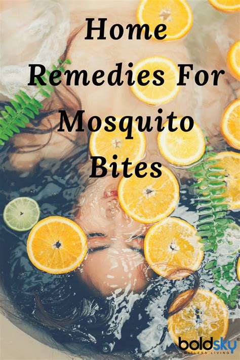 12 Home Remedies For Mosquito Bites To Bring Instant Relief