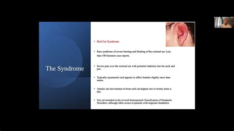 Duke Neurology Case Presentation Jacob Gardner Pa C Red Ear