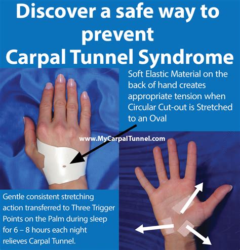 Preventing Carpal Tunnel Syndrome My Carpal Tunnel