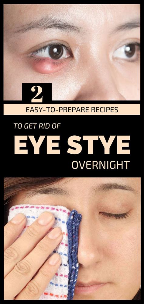 2 Easy To Prepare Recipes To Get Rid Of Eye Stye Overnight