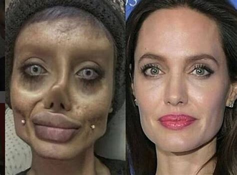 Teen S Botched Angelina Jolie Plastic Surgery Roils Internet Proves To