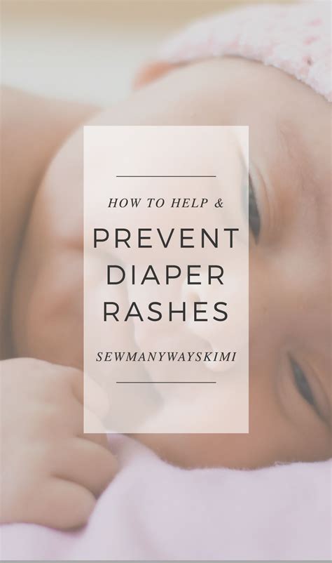 Help And Prevent Diaper Rashes Diaper Rash New Parent Advice Prevention