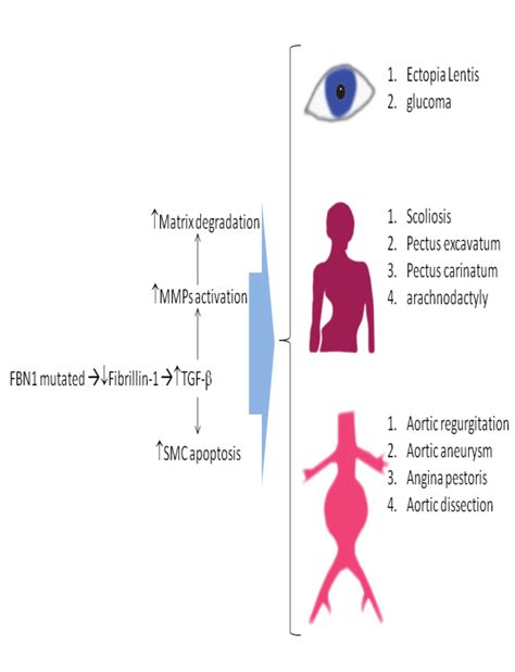 Schematic View Of Marfan Syndrome Pathophysiology Mutation In Fbn1 Download Scientific Diagram