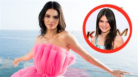 Wie knackt man krebse richtig? Akne-Probleme: Kendall Jenner spricht über ihren harten ...