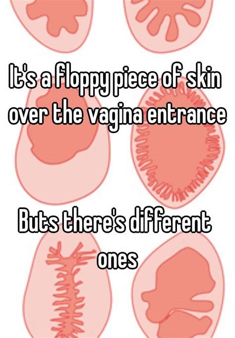Its A Floppy Piece Of Skin Over The Vagina Entrance Buts Theres