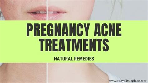 Best Pregnancy Acne Treatment Babys Little Place