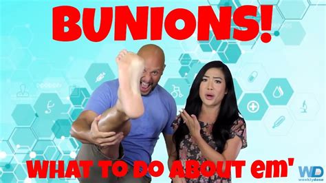 Read about bunion causes, treatment, prevention, and surgery complications. What are bunions? - YouTube