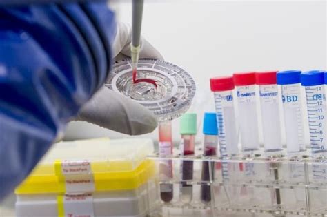 Blood Tests That Dont Hurt Tasso Inc Receives 3 Million To Advance