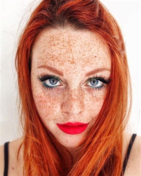 redhead freckles r welovefreckles