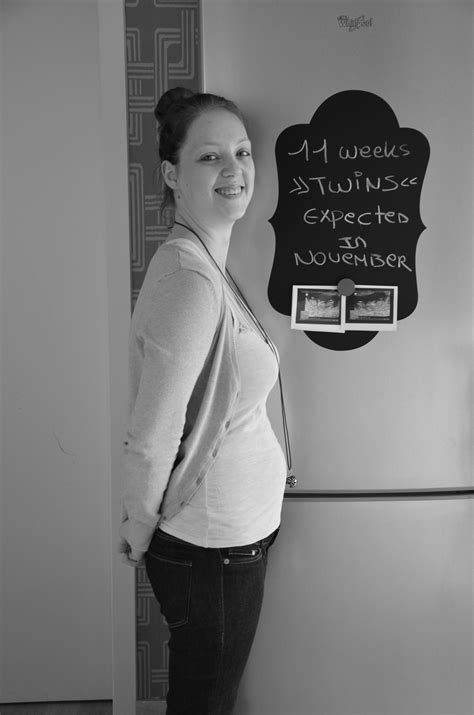 11 Weeks Pregnant Of Twins 11 Weeks Pregnant Twin Pregnancy Twins