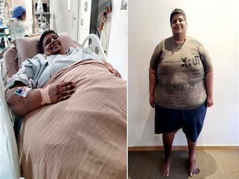 Bariatric Surgery Helps Man Weighing 262 Kgs Lose 41 Kg In One Month