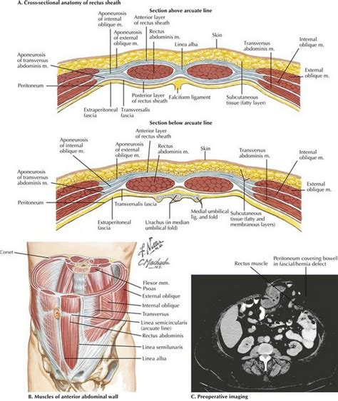 This section of the website will explain large and minute details of abdomen axial cross sectional anatomy. Abdominal Wall Anatomy and Ostomy Sites | Basicmedical Key