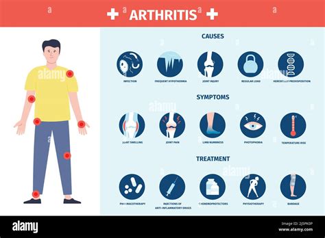 Arthritis Infographic Inflammation And Care Symptoms And Treatment