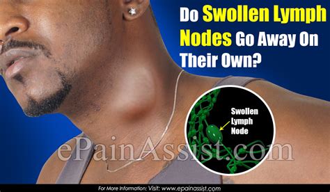 Do Swollen Lymph Nodes Go Away On Their Own