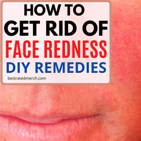 Diy Face Redness Remedieshow To Get Rid Ofnatural Ways To Reduce Face