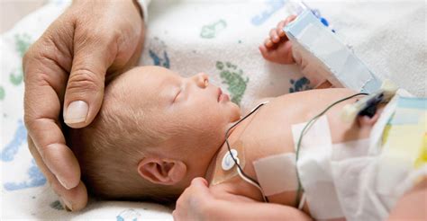 The 10 Best Neonatal Resuscitation Programs Near Me