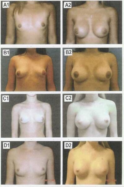 Visual Breast Cup Size Comparison Cumception