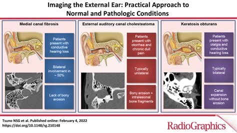 Imaging The External Ear Practical Approach To Normal And Pathologic