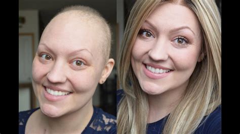 How To Keep Your Hair While On Chemo Tips And Tricks Best Simple