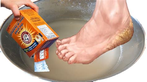 How To Use Baking Soda As A Treatment For Feet Calluses Foot Odor