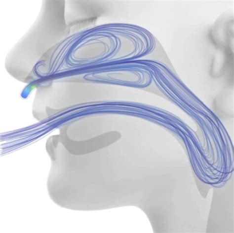 Infant flow variable flow inspiration: High-Flow Nasal Cannula (HFNC) in the ED - EMRounds