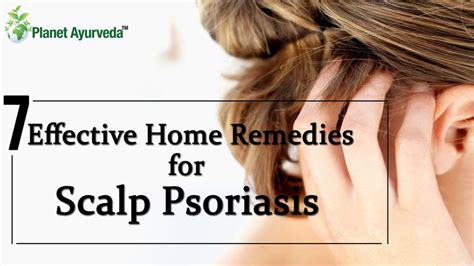 7 Effective Home Remedies For Scalp Psoriasis Scalp Psoriasis Hair