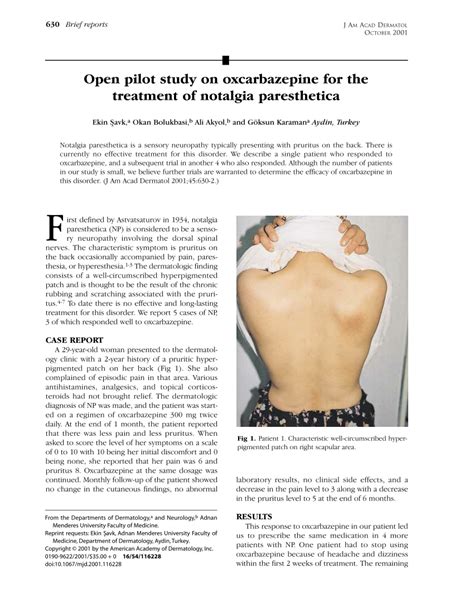 Pdf Open Pilot Study On Oxcarbazepine For The Treatment Of Notalgia