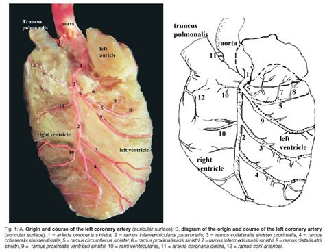 Macroscopic Description Of The Coronary Arteries In Swiss Albino Mice