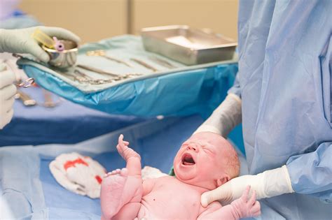 Photographer Shows C Sections Are Beautiful By Documenting Her Friend