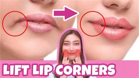 Lift Lip Corners Fix Droopy Mouth Corners Fat Around The Mouth