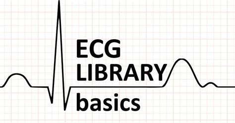 Q Wave Litfl Medical Blog Ecg Library Basics