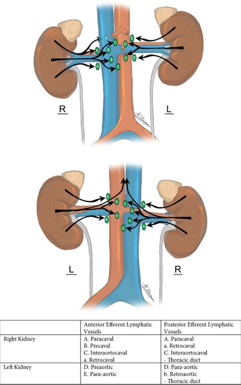 Lymphatic Drainage In Renal Cell Carcinoma Back To The Basics