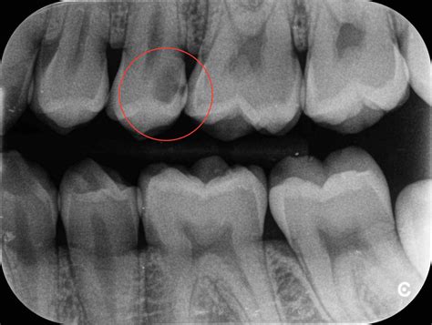 It consists of nasal skeleton, which houses the nasal cavity. Why take Radiographs? - Beecher Street Dental