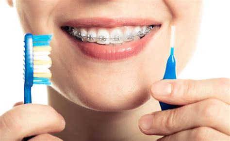 Care For Your Traditional Dental Braces Carrollton Smiles General Dentist