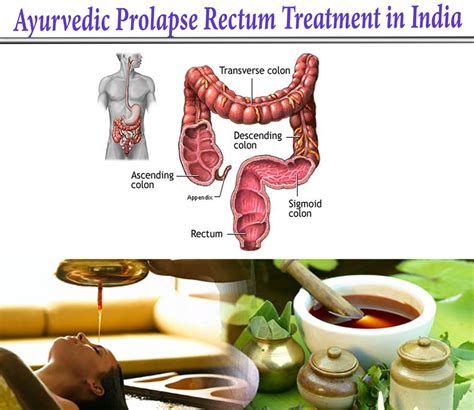 Get Familiar With Prolapse Rectum And Its Causes